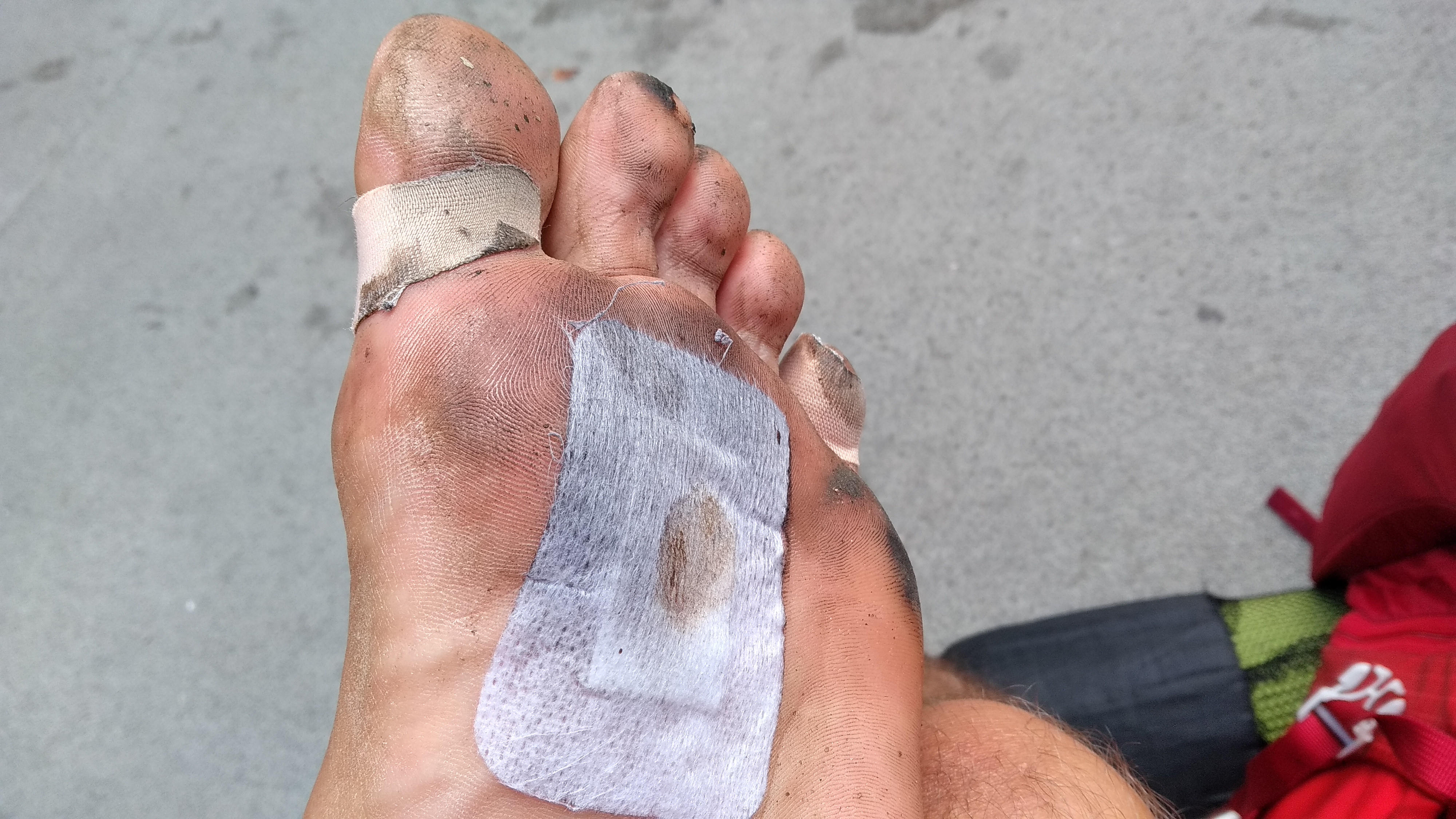 Blisters on the foot covered with plasters on camino to Santiago
