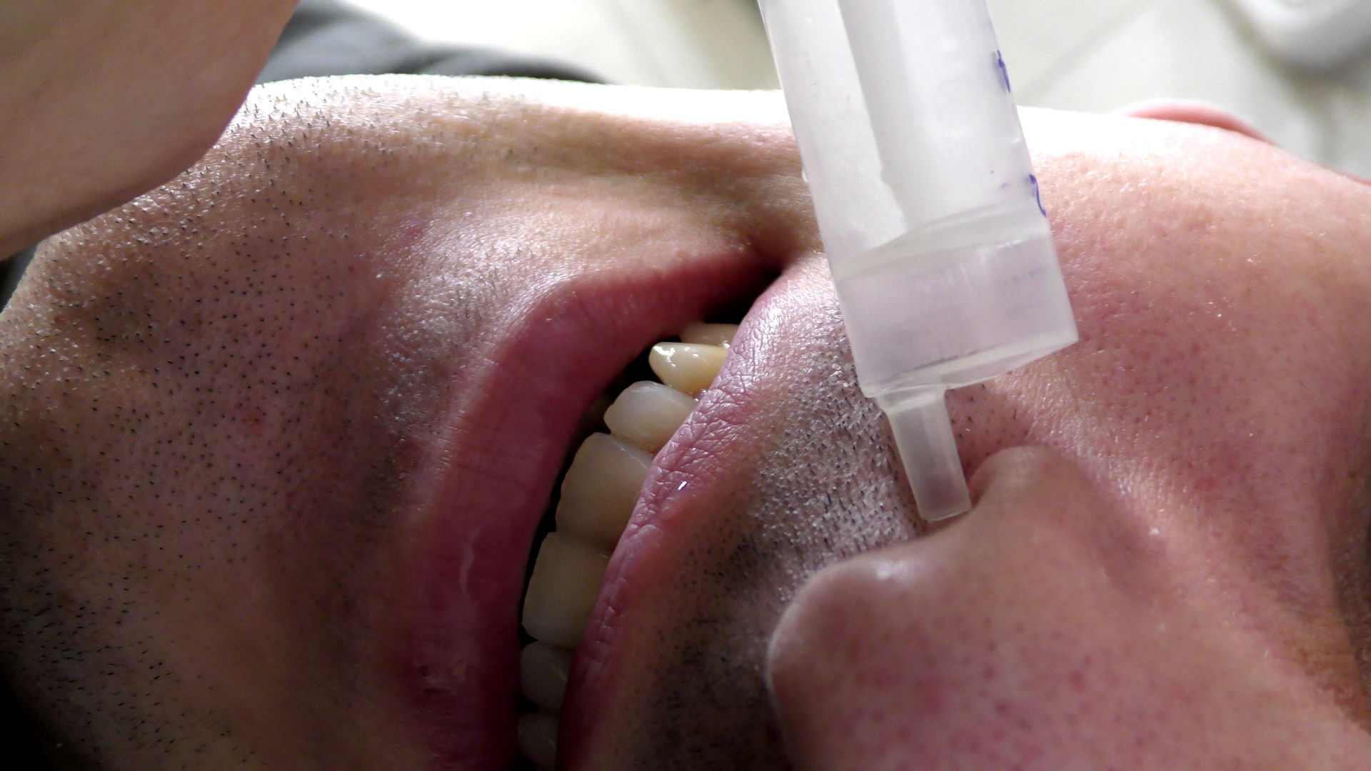 Saline rinse